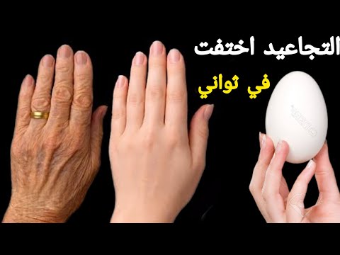 يديك تبدو مثل العجوز ‼️بيضة واحدة تخلصي من اسمرار وتشققات الأيدي نهائيا ومن الاستعمال الاول