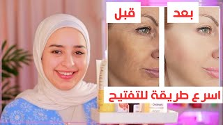 ازاي تفتحي بشرتك بسرعه من اسمرار الشمس – وتعالجي اثار الحبوب صح ؟