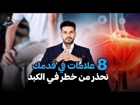 هل تعاني من هذه الأعراض؟ انتبه لصحة كبدك!