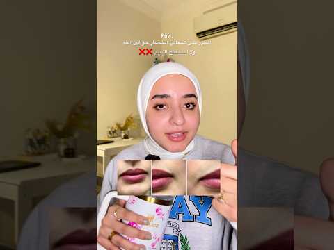 صدقيني الليزر مش الحل❌ الطريقه الصح لعلاج الخضار والغمقان حوالين الفم ‼️