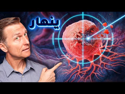 سرطان القولون المتقدم ينهار عند القيام بهذا الأمر