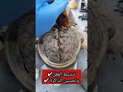 حبة واحدة فقط لزيادة الذكاء ولتنشيط العقل والذاكرة علاج النسيان للأبد #وصفات_طبيعية #وصفات #recipes