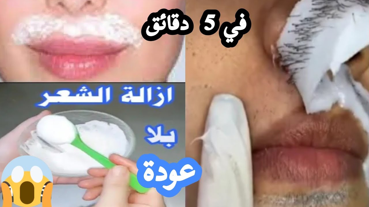 بدون الم‼️معلقة نشا ‼️لازالة شعر الوجه والجسم نهائياََ‼️من الجذور وبلا عودة ‼️