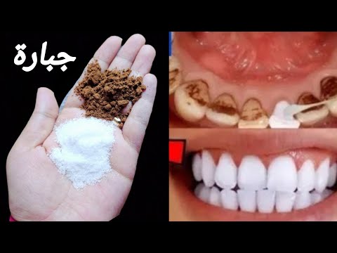 اقسم بالله ‼️ لن تحتاج للذهاب لطبيب الأسنان ‼️ لتبييض الأسنان واسقاط الجير ‼️ سيسقط لوحده