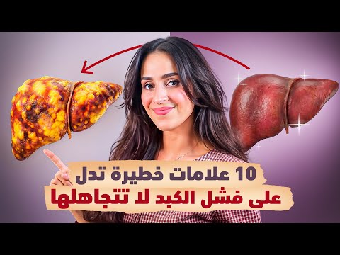 10 علامات خطيرة تدل على كسل الكبد .. والعلاج الصحيح | د.فجر الجميري