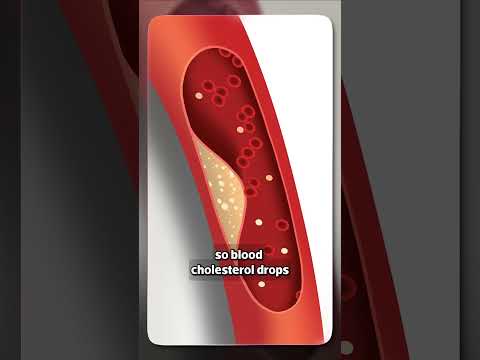 العدس غني بالألياف التي تساعد على تنظيم السكر وخفض الكوليسترول بشكل طبيعي.#دكريم_علي #فكر_تاني