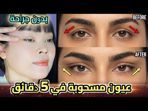 أفضل مساج لرفع العيون والحواجب في 5 دقائق 👁️ النتيجة ستصدمك! (بدون جراحة)