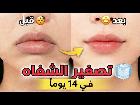 تصغير الشفاه طبيعياً في 14 يوماً! 👄 بدون جراحة (طريقة مجربة)