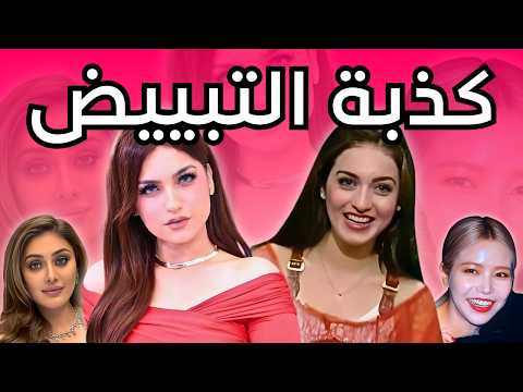 حقيقة التبييض: هوس مدمر و عنصرية مقنعة