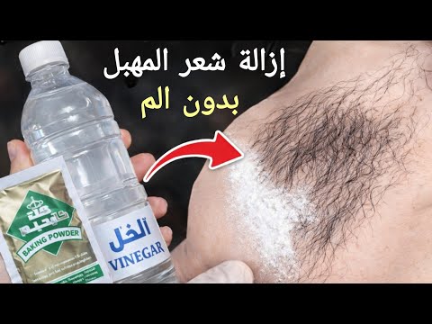الخل والبيكنج بودر‼️هتتخلصي من الشعر من الجذور‼️بدون الم ‼️انسي الطرق التقليدية