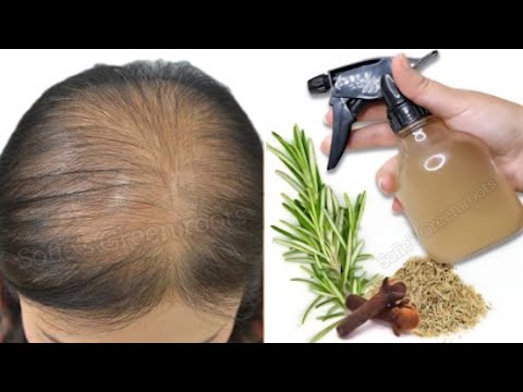 رشيها علي شعرك قبل النوم لمدة يومين! ينمو الشعر بسرعة كبيرة ولا يتساقط! فعالة ومجربة 100%