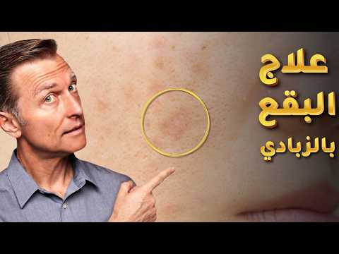 شركات كريمات الوجه أنذرتني لأني نشرت هذه المعلومة