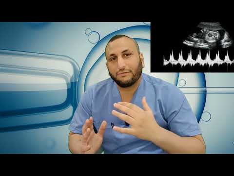 متى يبدأ نبض الجنين؟ الحقيقة التي لا تعرفها كل أم حامل! دكتور محمد خليل