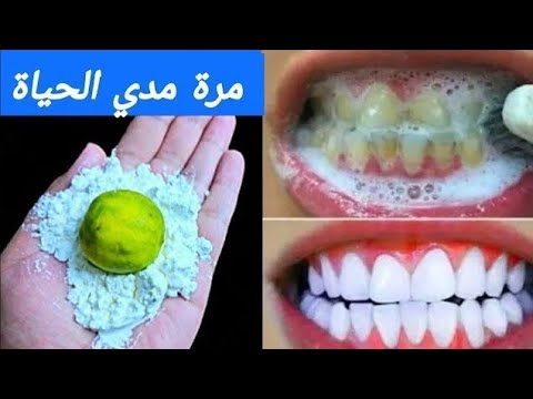 اقسم بالله ‼️ لن تحتاج للذهاب لطبيب الأسنان ‼️ لتبييض الأسنان واسقاط الجير سيسقط بدون رجعه