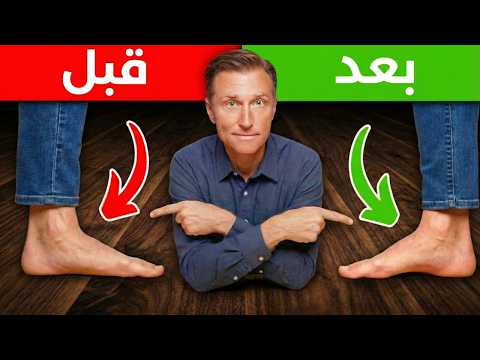 أقوى تمرين لعلاج القدم المنسطحة نهائياا