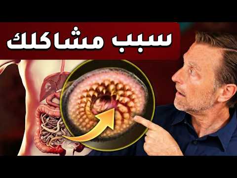طفيليات في بطنك وراء جميع مشاكلك حـ ـاربها بهذه الطريقة