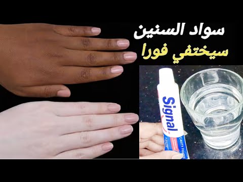 معجون الأسنان والماء❗تبييض الجسم كامل في دقائق قسما بالله مجربةضعيها على الوجه سواد سنين سيخرج فوراً