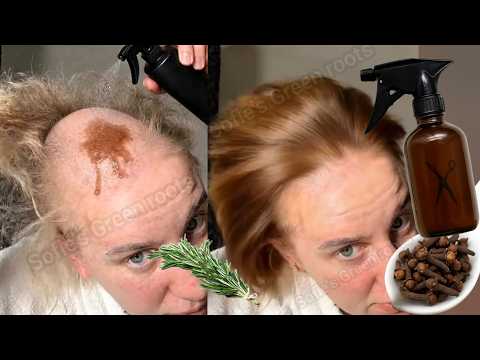 📌نمو الشعر بشكل جنوني في 7 أيام فقط! لن يتوقف شعرك عن النمو ابدا