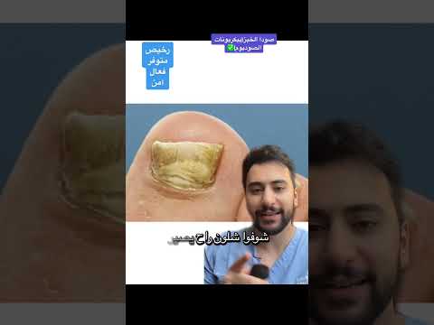سر لاستخدام صودا الخبز ( الكربونات ) لجميع مشاكل البشرة ✅