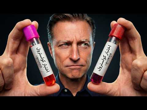 تم الكشف عن الكولسترول | كيف خدعونا