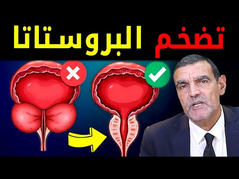 علاج تضخم البروستاتا النهائي مع الدكتور الفايد ….بدون ادوية تخلص من مشاكل التبول فى أيام فقط؟