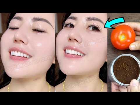 ماسك تبييض وتفتيح التصبغات و اثار الحبوب والكلف‼️5 دقائق وستنبهرين ببشرة جديدة وزجاجية