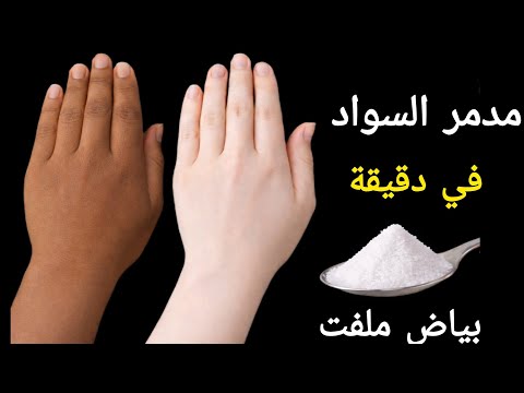 معلقة ملح‼️ضعيها على يدك والسواد ولن تصدقي النتيجة‼️تبييض اليدين تبييض فوري من اول استخدام ‼️