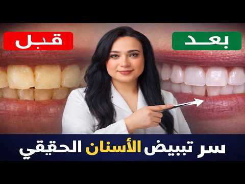 أفضل وصفة على الأطلاق لتبييض الأسنان والتخلص من الجير والتكلسات بمكونين فقط !