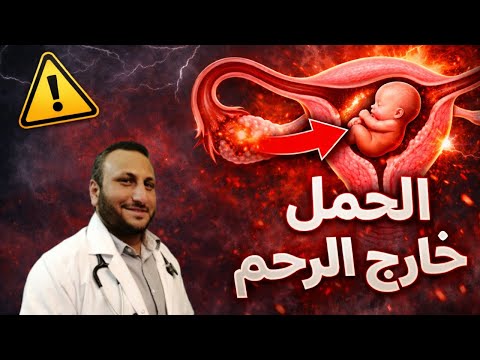أهم أسباب الحمل خارج الرحم | كل سيدة لازم تعرف الحقيقة