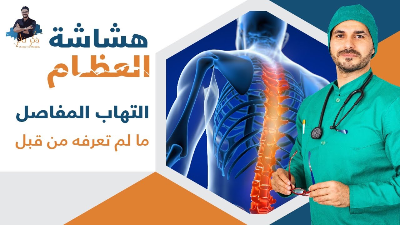 علاج هشاشة العظام والتهاب المفاصل الفعال _تاكل الغضاريف _ كلام لم تسمعه من قبل‎