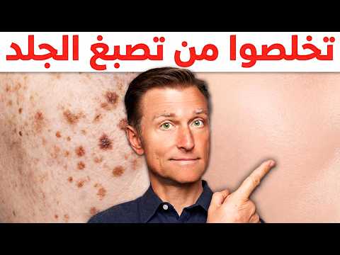 كذبوا وقالوا إنها بقع لا تزول