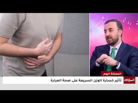 الدكتور فراس الطراونة يتحدث عن تأثير خسارة الوزن السريعة على صحة المرارة  على قناة المملكة
