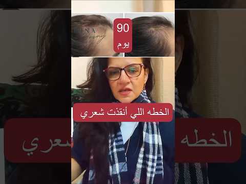 هترجعي شعرك اقوي من الاول بس اديني 90 يوم