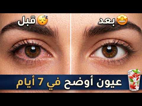عيون أوضح في 7 أيام 👁️✨ اشربي هذا لتقليل الشعيرات الظاهرة (بدون قطرات)
