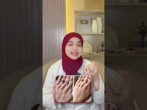 كريمات الحفاظات كنز ف بيتك