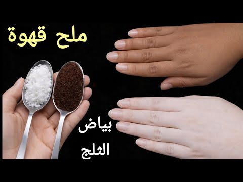 الملح والقهوة‼️ يزيل سواد 20 سنة💥 تبييض الوجه والجسم والمناطق الحساسة في 5 دقائق فقط