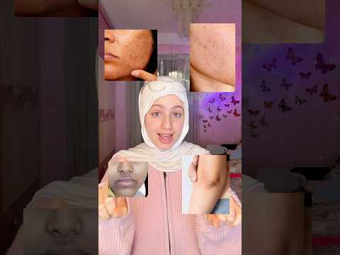 ⁨ إيه هو فرط التصبغات؟ وإزاي تقدري  #hyperpigmentation تخففيه بطريقة صح!✨