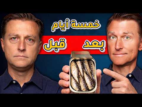 ريجيم السردين لخمس أيام فقط سيفعل هـ ـذا بجسمك