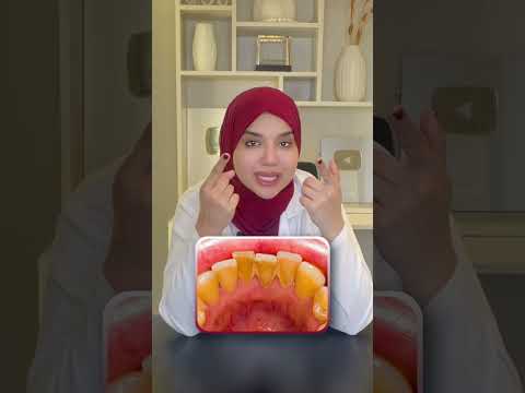 ريحة النفس الكريهة