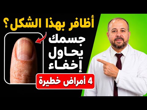 تحذير طبيب الأعصاب: إذا ظهرت أظافرك هكذا بعد سن الستين، فقد يكون جسمك يخفي 4 أمراض