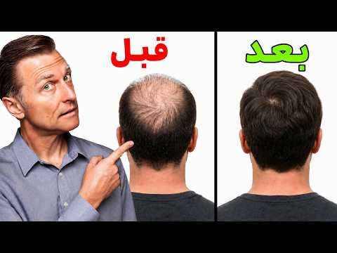 بصيلاتك ليست ميتة… هكذا توقظها من جديد | تحفيز بصيلة الشعر