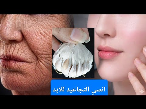 معجزة الثوم 🧄❗ ضعيها على التجاعيد وستختفى كأنك في العشرين من عمرك🌟قناع الثوم لبشرة متوهجة بيضاء