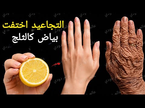 يديك تبدو مثل العجوز ‼️ ليمونة واحدة‼️هتتخلصي من اسمرار وتجاعيد الايد نهائيا ‼️من اول مرة