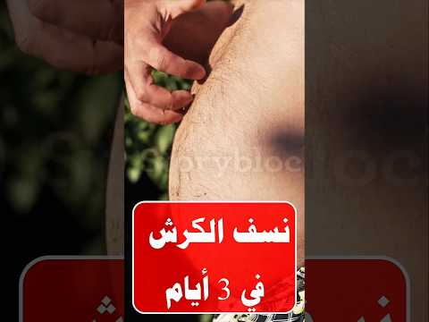 نظام ينسف الكرش في ٣ أيام ( بروتوكول الطواريء )