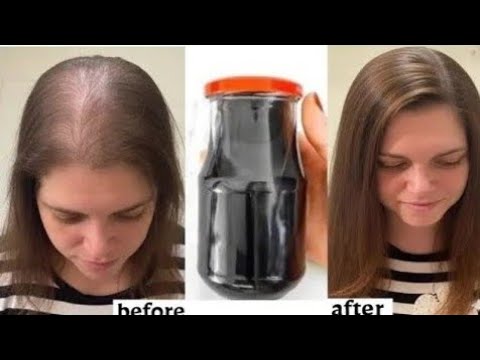 رشيه علي شعرك لمده يومين فقط ‼️هيخلي شعرك زي الباروكة ‼️تطويل وانبات ووقف التساقط