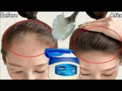 كيفية استخدام الفازلين ‼️هيخلي شعرك زي الباروكة ‼️ يزيل الصلع وتساقط الشعر
