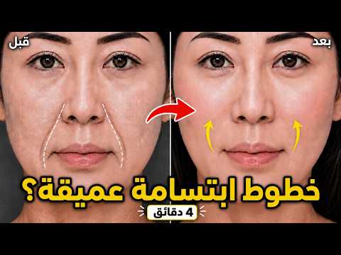 خطوط ابتسامة عميقة؟ 4 دقائق لرفع الخدود
